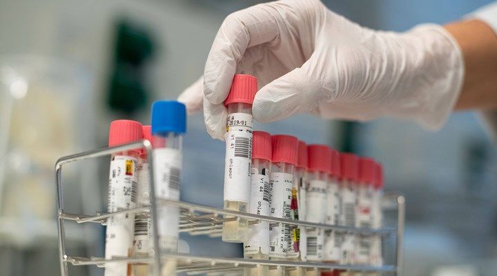 Azərbaycanda koronavirus ilə bağlı son vəziyyət açıqlandı - YOLUXMA AZALIR, SAĞALANLAR ARTIR