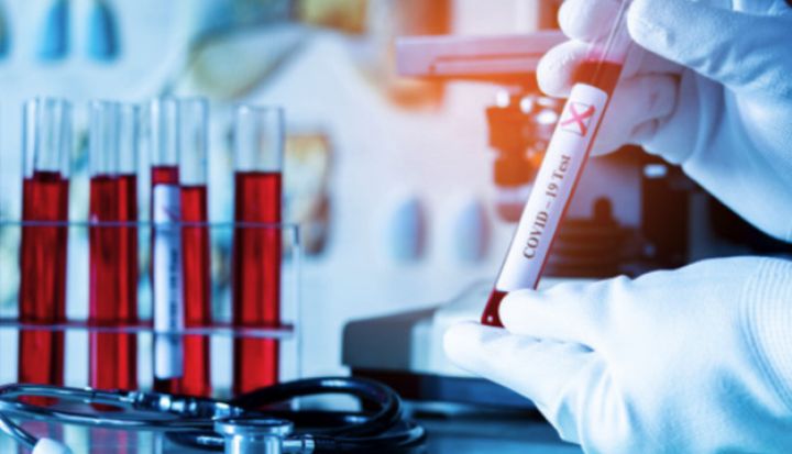Azərbaycanda koronavirus ilə bağlı son vəziyyət açıqlandı
