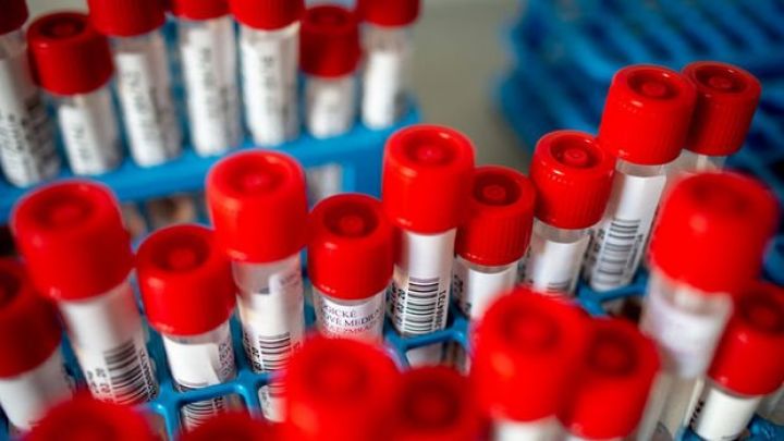 Azərbaycanda koronavirusa yoluxma faktında yeni rekord